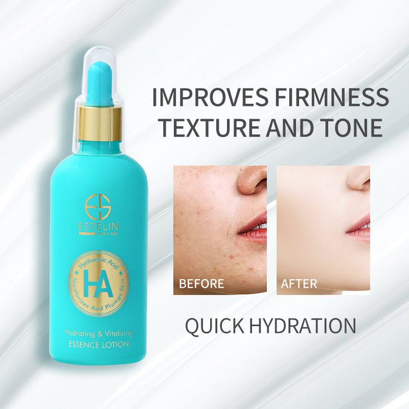 Hyaluronic acid hydrating & vitalizing lotion
