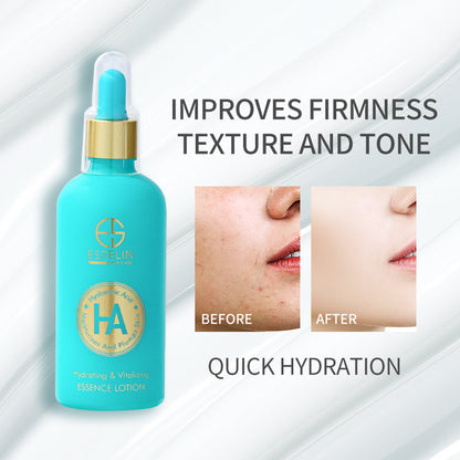 Hyaluronic acid hydrating & vitalizing lotion