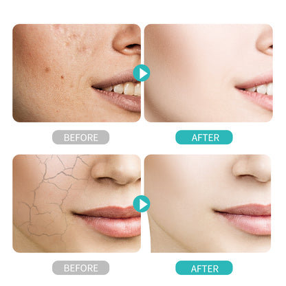 Hyaluronic acid hydrating & vitalizing lotion