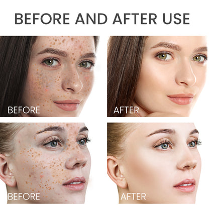 Rosehip& Niacinamide spots fading face serum