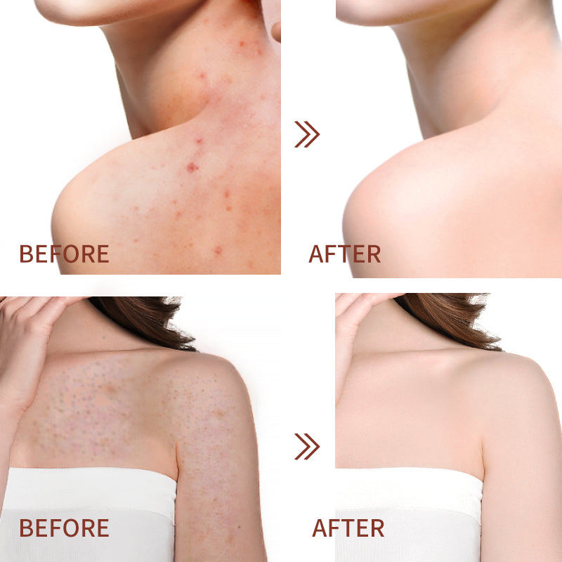 Coconut oil &Vitamin E  Exfoliating & Moisturizing bath salts