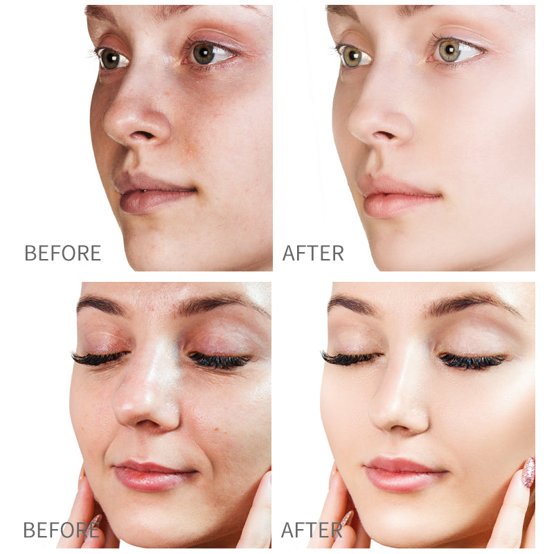 Niacinamide fade spots face wash